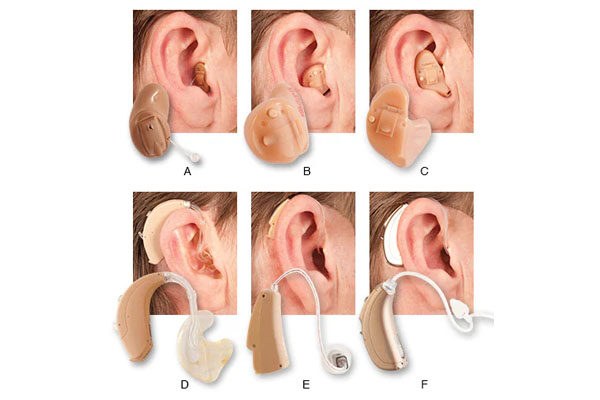 All Types of Hearing Aids Available